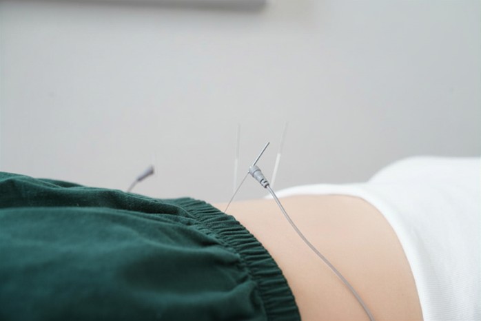 AcupunturaEstética